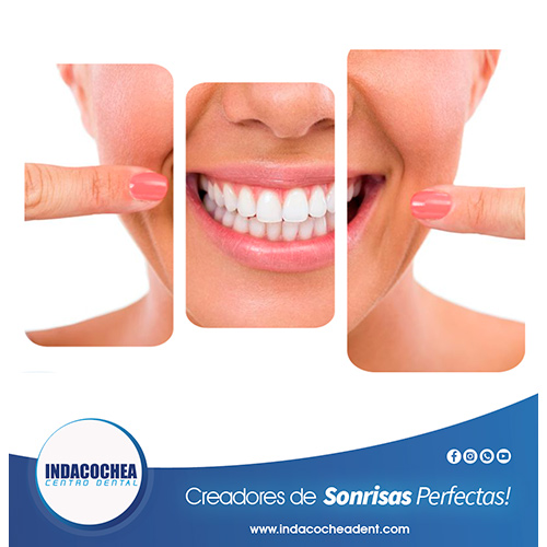  clinica dental diseño de sonrisa