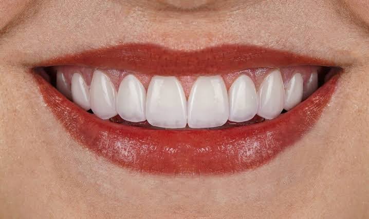 Sonrisa de adulto
