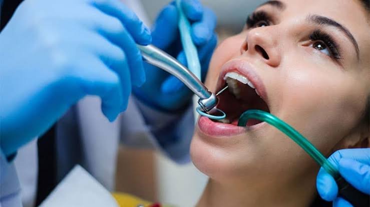 Restauraciones Dentales en Guayaquil