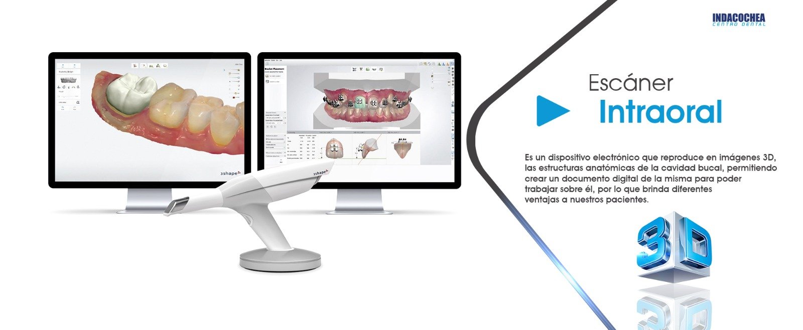 Diseño de sonrisa en Indacochea Centro Dental