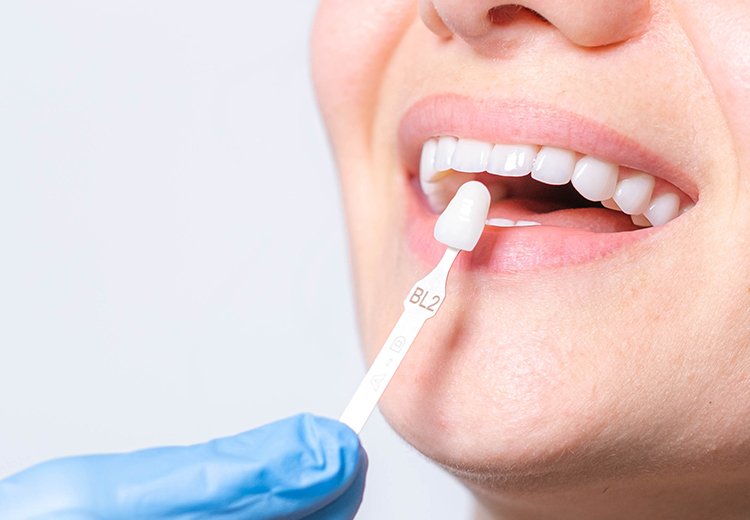 Rehabilitación Oral